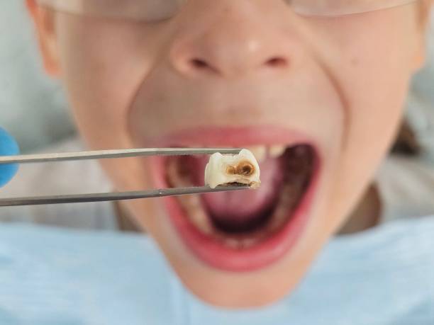 Best Walk-In Emergency Dentist in Schler Park, IL